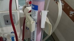 Berbahayakah Penggunaan Alat Cuci Darah yang berulang?